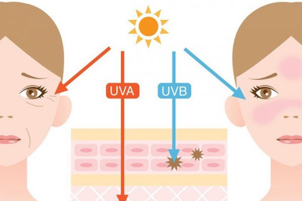 Tac dong cua anh nang 600x400 - Viên uống trắng da và cách giải tỏa nỗi lo cùng Hanvely