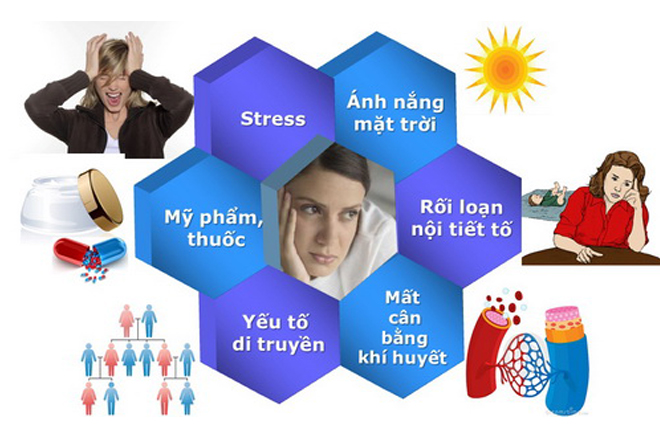 Viên uống trắng da và cách giải tỏa nỗi lo cùng Hanvely yeu to gay nam da - Viên uống trắng da và cách giải tỏa nỗi lo cùng Hanvely